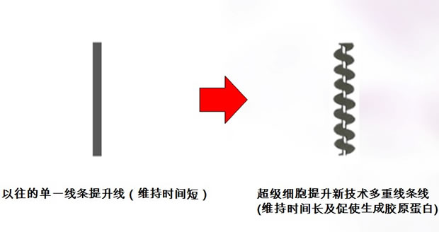 以往的提升手术与HERSHE超级细胞提升的差异
