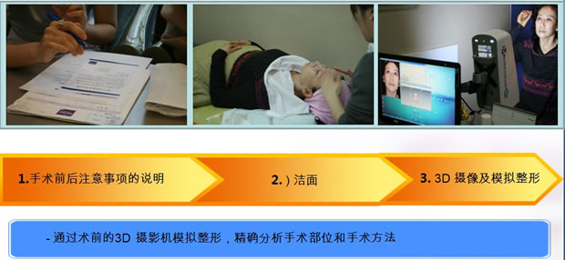 超级面部提升诊疗过程